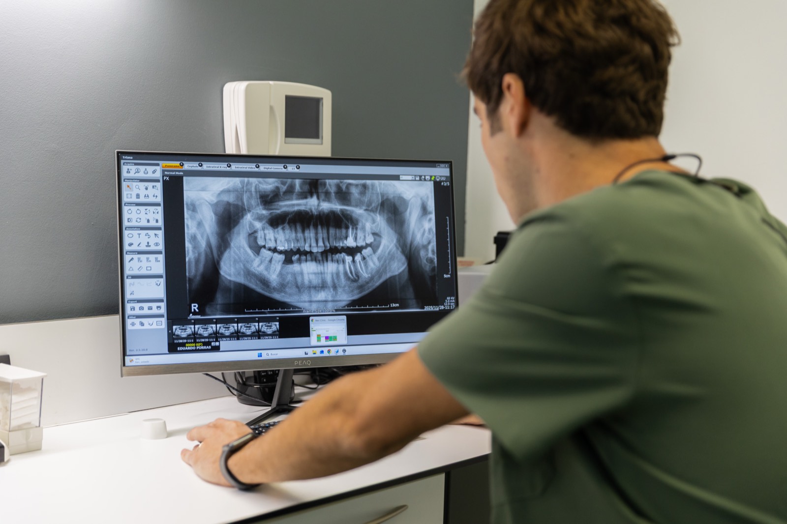 Doctor revisando una radiografía panorámica en pantalla