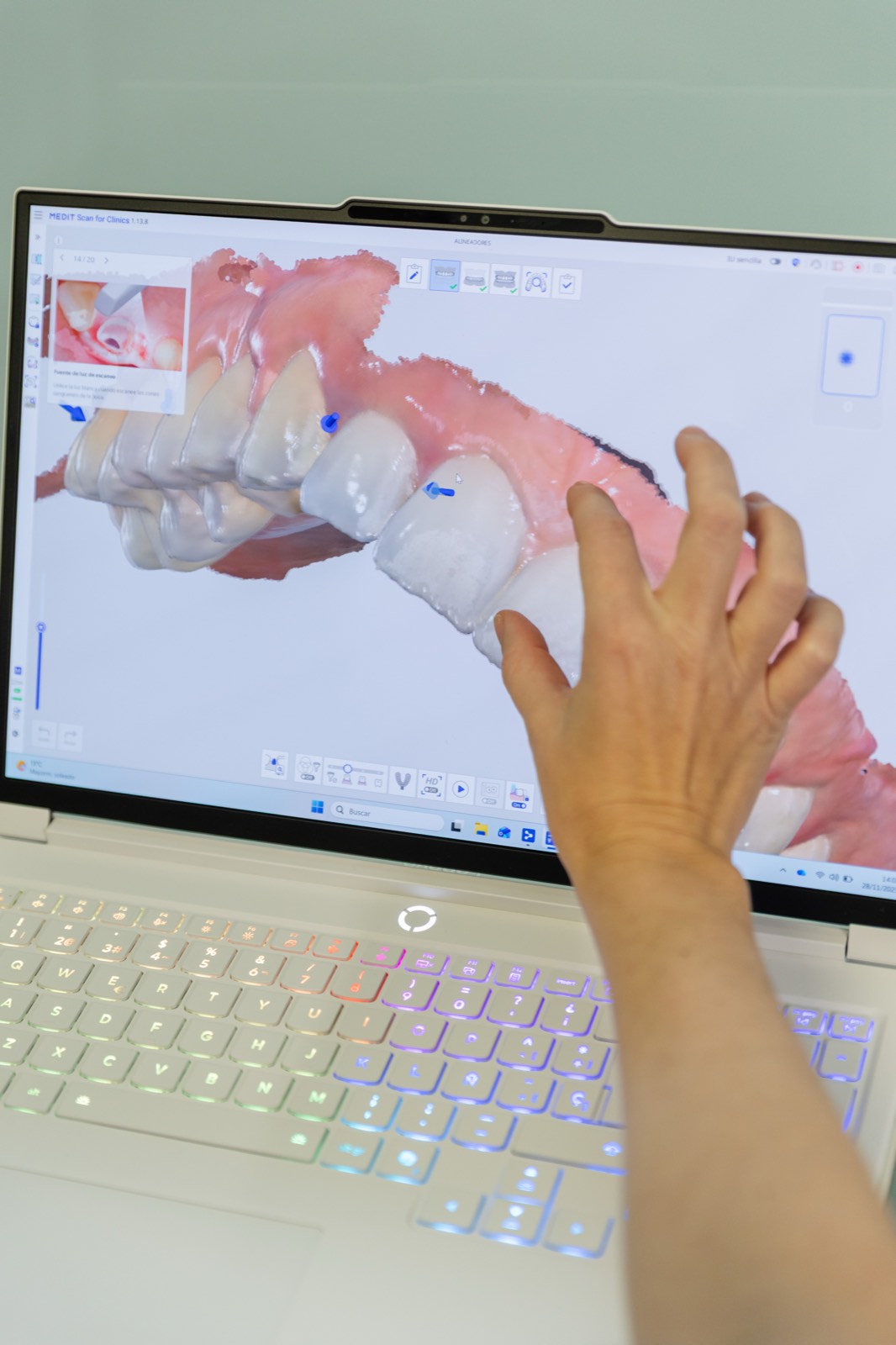 Escaneado dental digital en 3D en pantalla